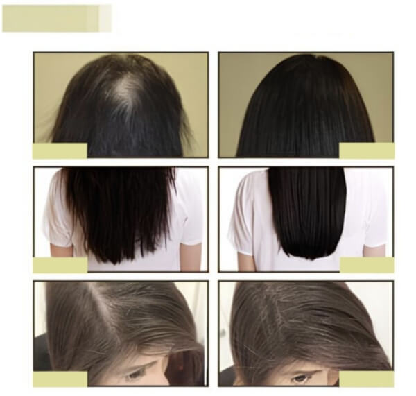 EELHOE Hair Growth Oil – Mi ez és hogyan működik?